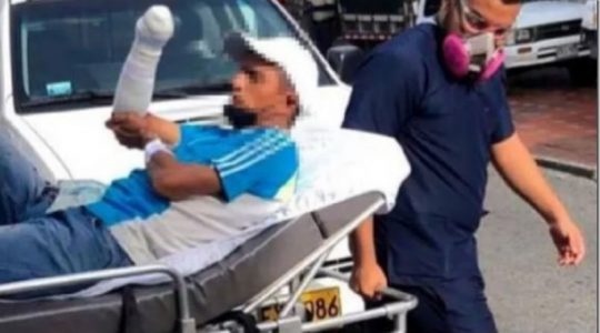 Por supuestamente piropear a una mujer le mutilaron la mano a un venezolano en Colombia