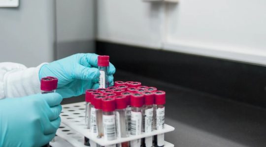 El CSIC desarrollará una tecnología para crear sangre artificial